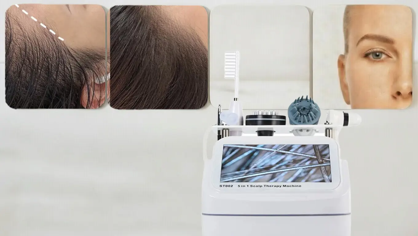 اسکالپ و لاین مو